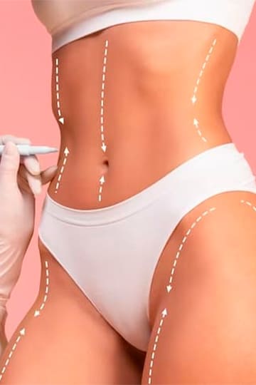 Tratamento para Gordura e Flacidez Corporal