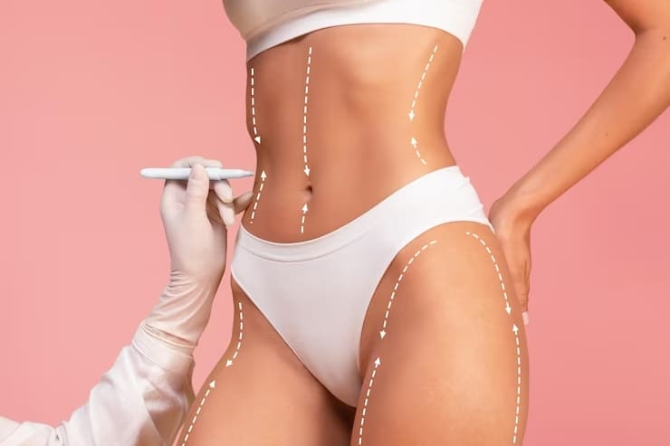 Tratamento para Gordura e Flacidez Corporal